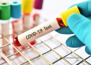 مثبت کیسوں میں مزید کمی ،۲۱ نئے کیس سامنے آئے