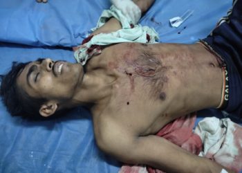 رتنی پورہ پلوامہ میں مشتبہ ملی ٹینٹوں کی فائرنگ میں دوغیر مقامی مزدور زخمی