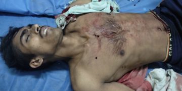 رتنی پورہ پلوامہ میں مشتبہ ملی ٹینٹوں کی فائرنگ میں دوغیر مقامی مزدور زخمی