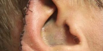 پٹن میں ساتھی کا کان کاٹنے پر استاد گرفتار