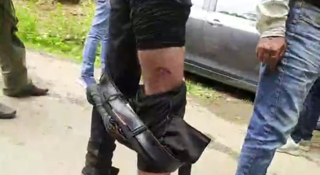 بادام واری میں پاگل کتے نے چار افراد کو کاٹ کھایا، علاقے میں خوف ودہشت