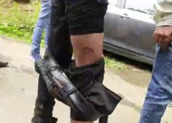 بادام واری میں پاگل کتے نے چار افراد کو کاٹ کھایا، علاقے میں خوف ودہشت