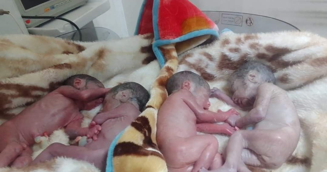کپواڑہ:خاتون نے چار بچوں کو جنم دیا‘ تین بچ نہیں سکے